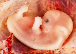 Pourquoi plaider pour le respect inconditionnel de l’embryon humain ?